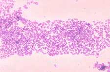 Micrococcus mucilaginosis