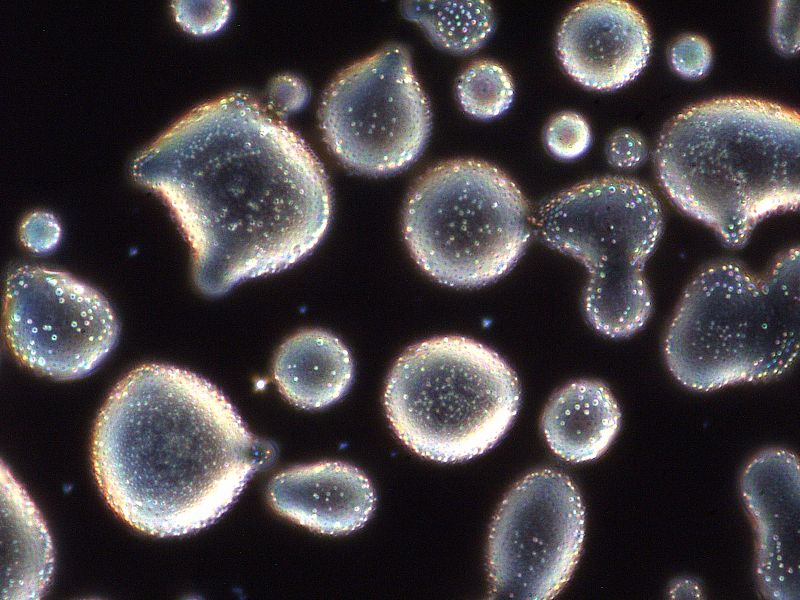 File:Optilise mikroskoobi kujutis vedelkristalli tilkadest klaasis 100x.jpg