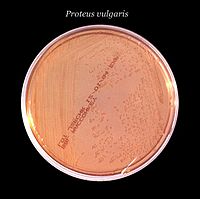 Mac Conkey Agar - Wikipedia bahasa Indonesia, ensiklopedia 