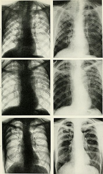 File:Radiography, X-ray therapeutics and radium therapy (1916) (14758337915).jpg