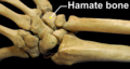 Right hand posterior view (dorsal view). Thumb on bottom.