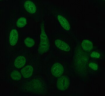 Anti-SSA/Ro autoantibodies