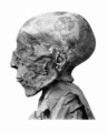 Kopf der Mumie von Sethos II.