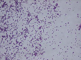 Staphylococcus saprophyticus.jpg