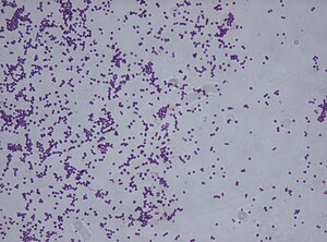 Staphylococcus saprophyticus after Gram stain