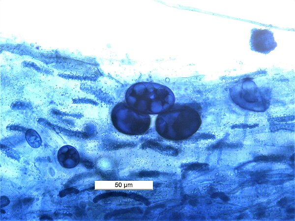 Vesicles in Vesicular Arbuscular Mycorhizae in root of Macrotyloma uniflorum .