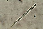 Bacidia schweinitzii-7.jpg