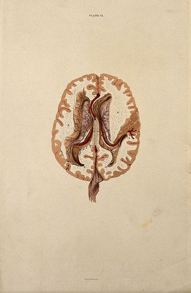 File:Brain; horizontal section showing lateral ventricles. Colour