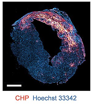 A fluorescence image of an axial cross section of a mouse heart at day 14 post myocardial infarction, stained with Hoechst 33342 (blue) and biotin-labeled CHP (detected with AlexaFluor647-streptavidin, red). Scale bar: 1 mm. CHP mouse heart section.jpg