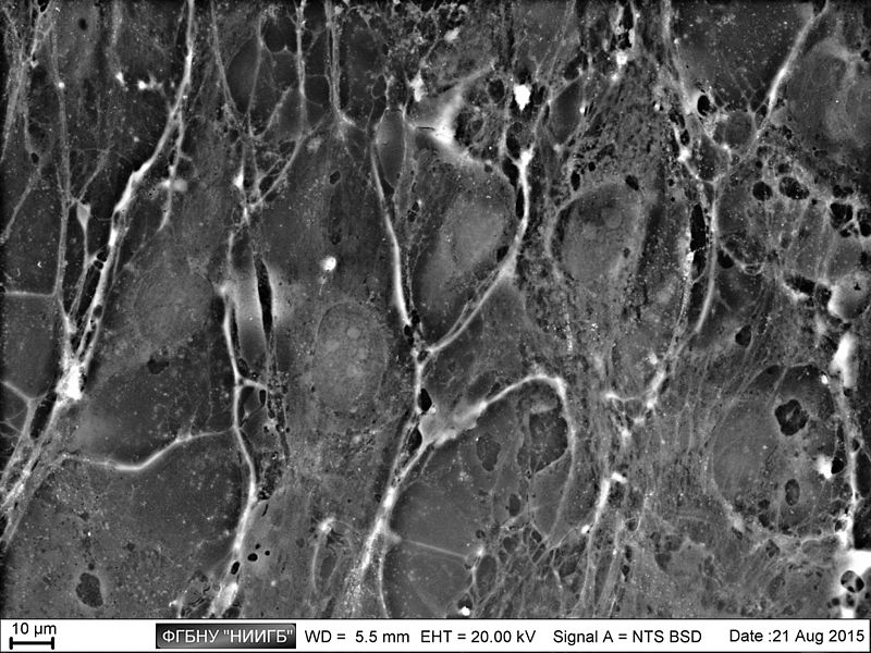 File:Limbal epithelial cells. Monolayer. SEM-BSE.jpg