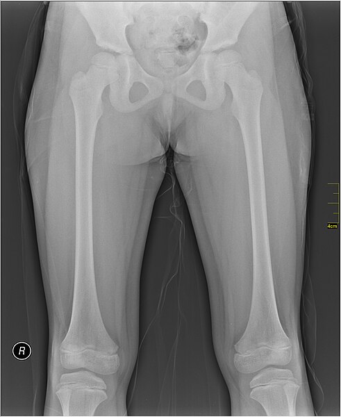 File:Medical X-Ray imaging KXD05 nevit.jpg