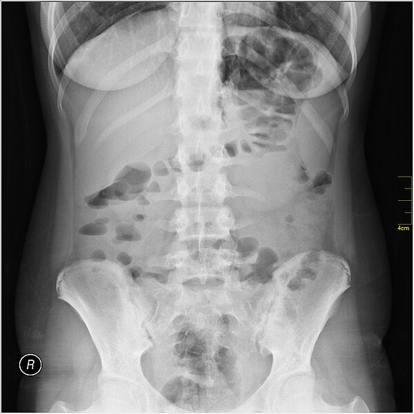 File:Medical X-Ray imaging TPZ07 nevit.jpg