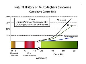 Peutz–Jeghers Syndrome