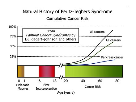 Most people with Peutz–Jeghers syndrome will have developed some form of neoplastic disease by age 60.