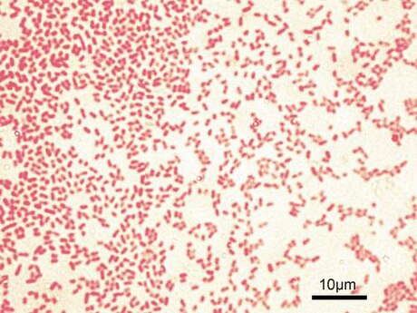 Bacteri gramnegatiu