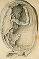 Researches on the pathology and treatment of some of the most important diseases of women (1833) (14771118494).jpg