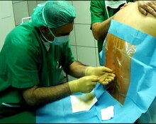 Plik:Spinal anaesthesia.ogv