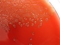 Streptococcus pneumoniae columbia agar.jpg