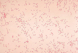 alcaligenes faecalis gram stain