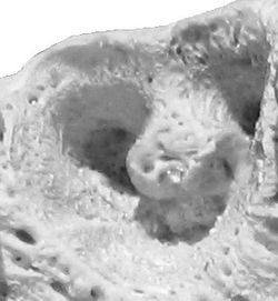 Alveole zahn.jpg