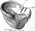 Miniatura para Esplenomegalia