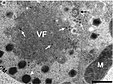 Virus infectés par des virophages.