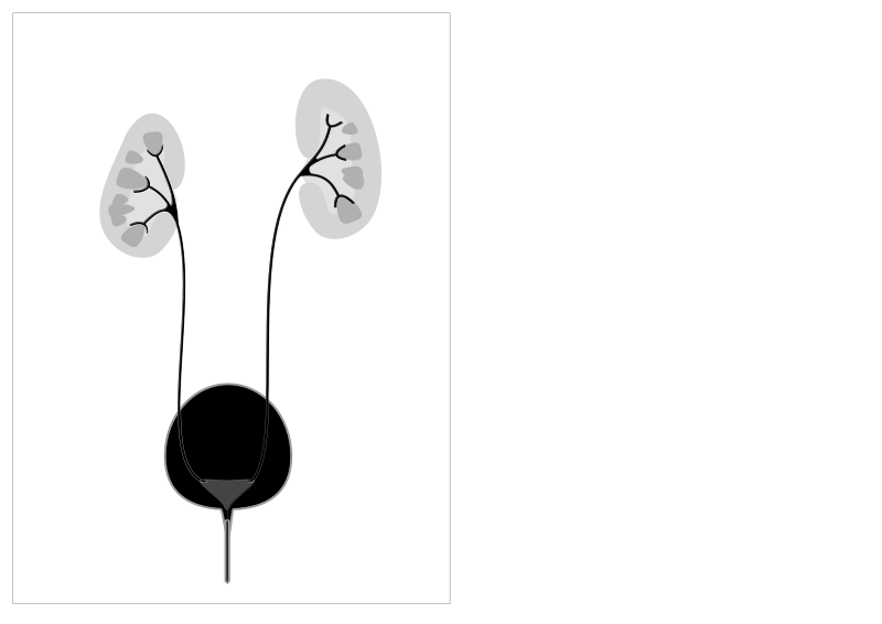 File:Grade 2 Vesico Ureteric Reflux.svg