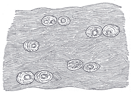 Cartilagem fibrosa