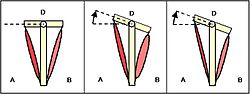 Vorschaubild für Muskuläre Dysbalance