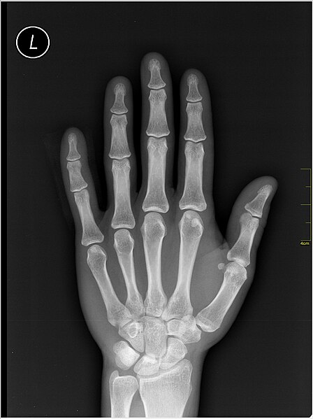 File:Medical X-Ray imaging PUX06 nevit.jpg