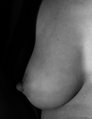 Profile Woman Breast.png