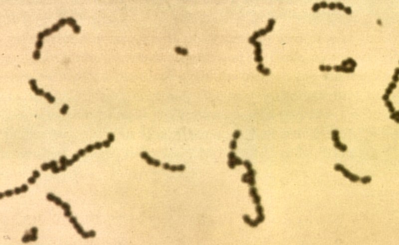 File:Streptococci.jpg