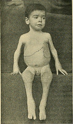 The diseases of children - medical and surgical (1900) (14781042361).jpg