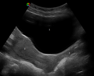 Vagina: Anatomia umana, Fisiologia, Aspetti clinici