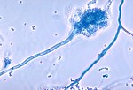Nấm Aspergillus fumigatus với các bào tử nang