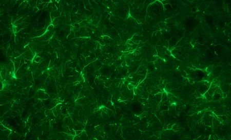 ไฟล์:Astrocyte_-_rat_spinal_cord_-_GFAP.jpg