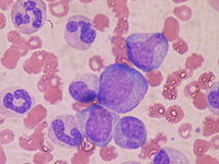 Hematopoyesis: Tejido hematopoyético, Concepto, Mielopoyesis