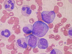 Hematopoietic precursor cells: promyelocyte in the center, two metamyelocytes next to it and band cells from a bone marrow aspirate Bone marrow WBC.JPG