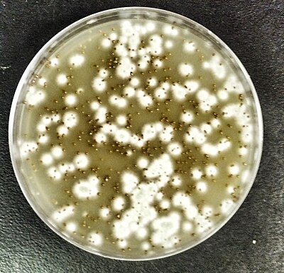 Грибы в кале. Дрожжи Cryptococcus terricolus. Дрожжевой гриб Cryptococcus neoformans.. Cryptococcus neoformans на чашке Петри.