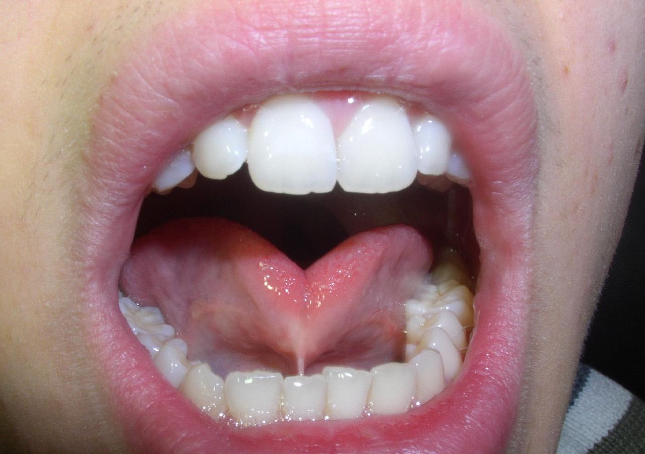 Frenulum linguae.jpg