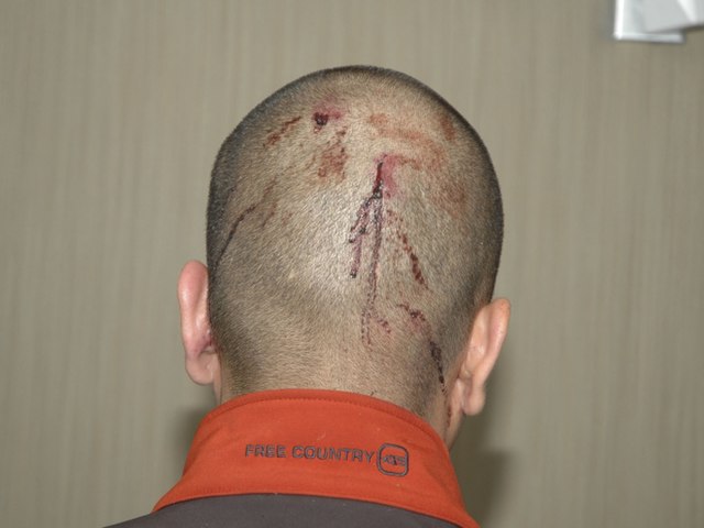 The back of Zimmerman's head at the police station
