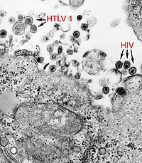 HTLV-1 och HIV-1 EM 8241 lores.jpg