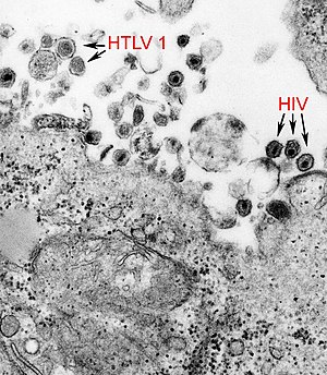 사람T세포림프친화바이러스와 인간면역결핍 바이러스