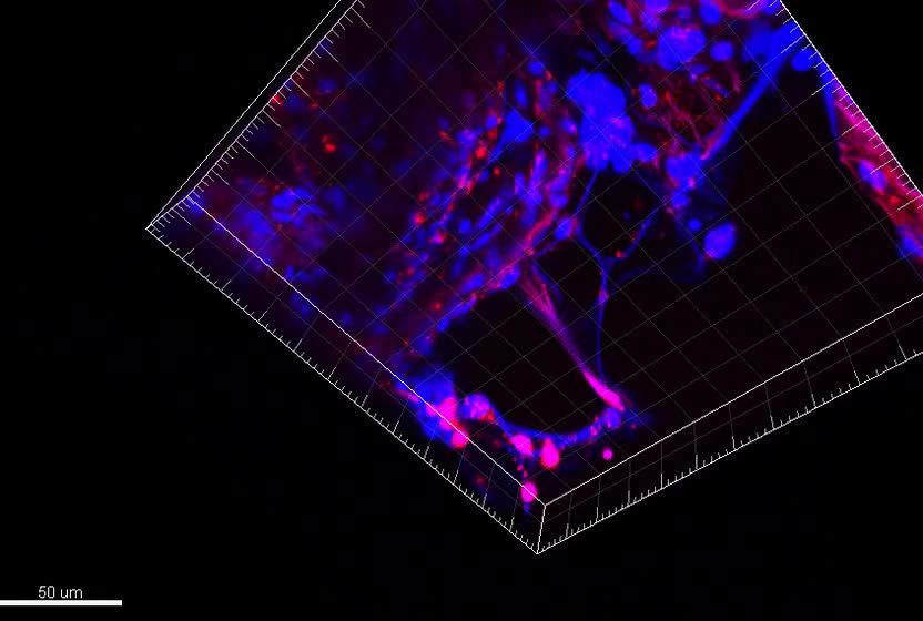 mesothelioma qocs