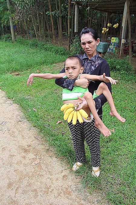 Tập_tin:Begging_woman_with_disabled_child_Vietnam.jpg