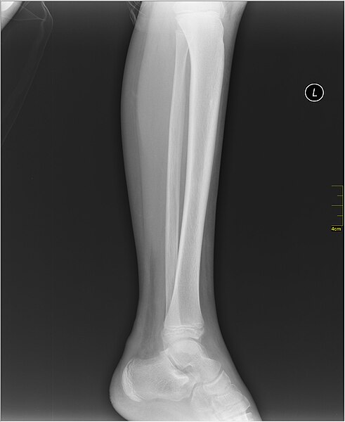 File:Medical X-Ray imaging OSK06 nevit.jpg