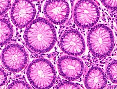 Micrografia di normali grandi cripte intestinali.