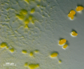 Myxococcus swarming and fruiting bodies.png