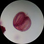 Thumbnail for Palynology