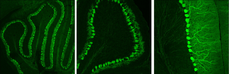 File:Purkinje neurons in the cerebellum.png